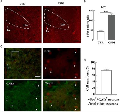 GABAergic synapses from the ventral lateral septum to the paraventricular nucleus of hypothalamus modulate anxiety